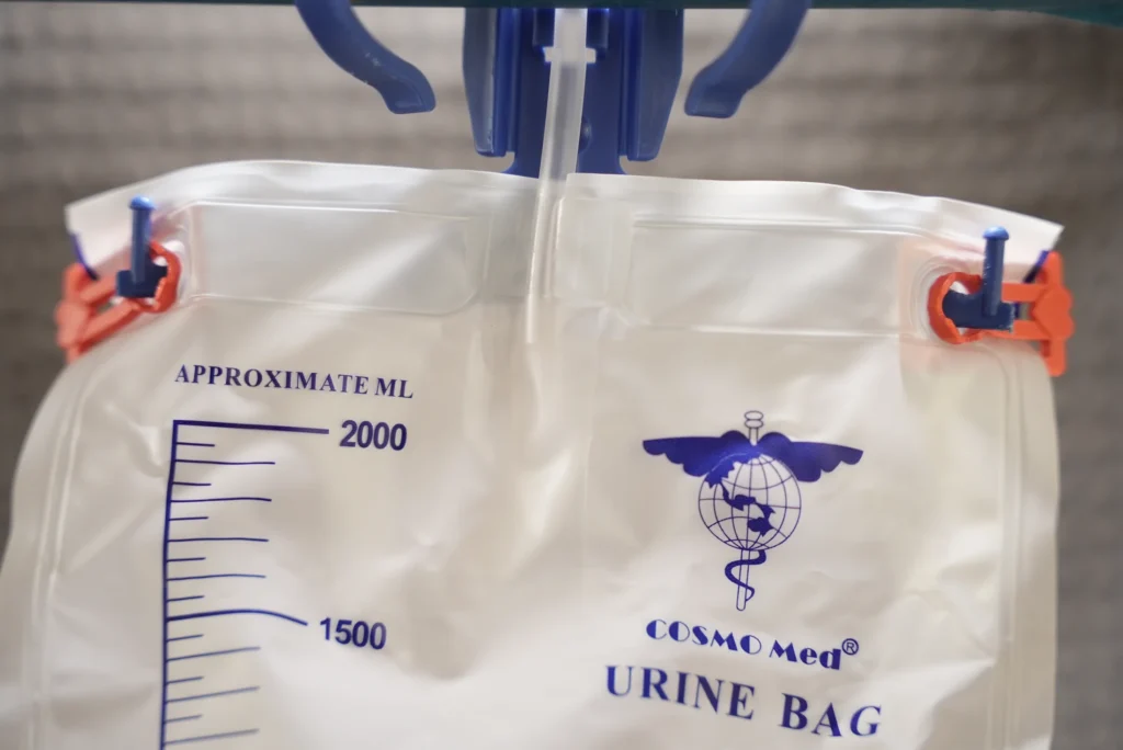 Two Uroclips fitted over the hanging holes of a demonstrated compatible urine bag