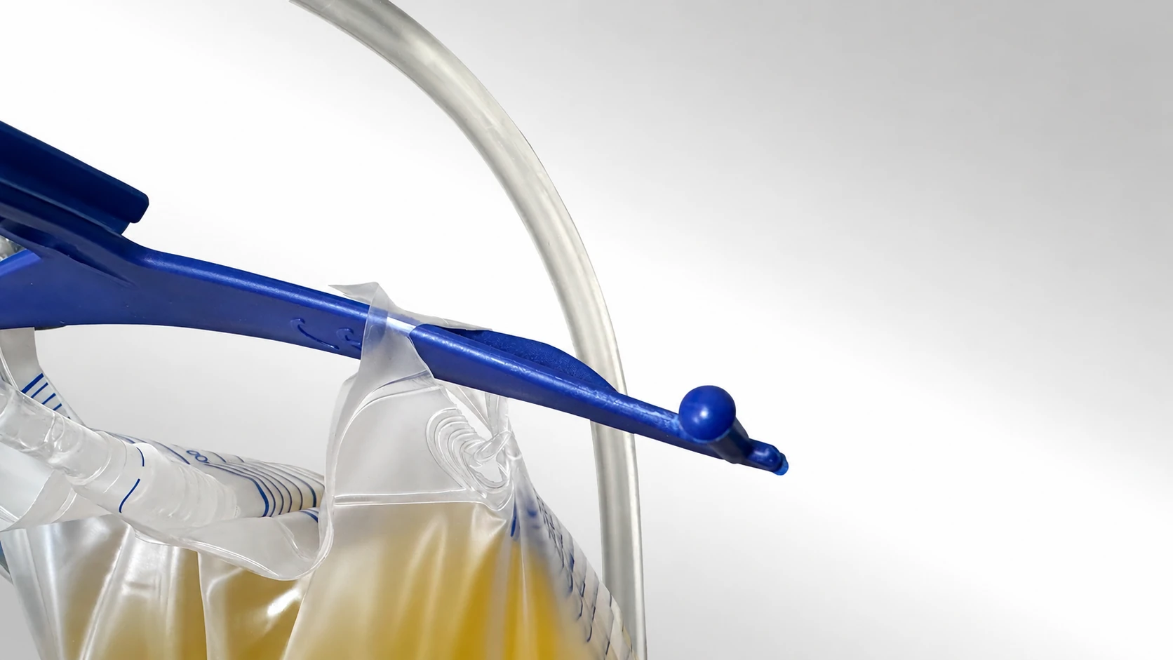 Urine bag with tearing around the upper hanging-hole area